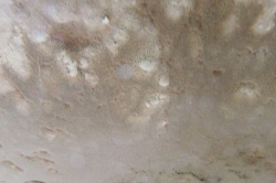 Pores
