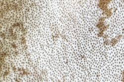 Pores